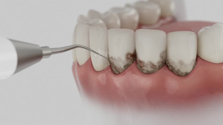 Reliable Dental Implants contractor in Valparaiso, FL by Smile Center Dentistry